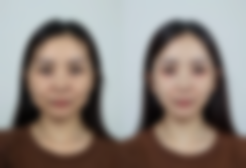 八、南宁霓肤整形医院怎么预约？