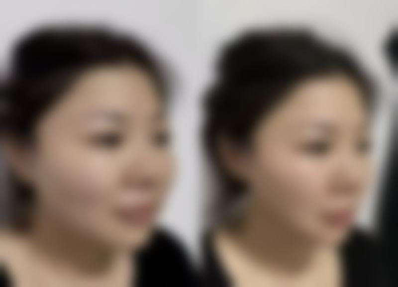 五、南宁霓肤整形医院收费价格表