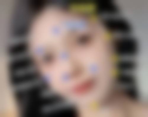 打瘦脸针会中毒吗？揭秘中毒诱因、症状及案例，教你选正规机构避免风险！ 