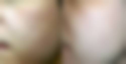 日常护理：不可忽视的疤痕淡化辅助措施