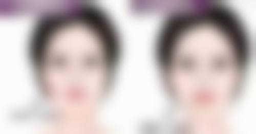 医美手段：快速改善眼纹眼袋