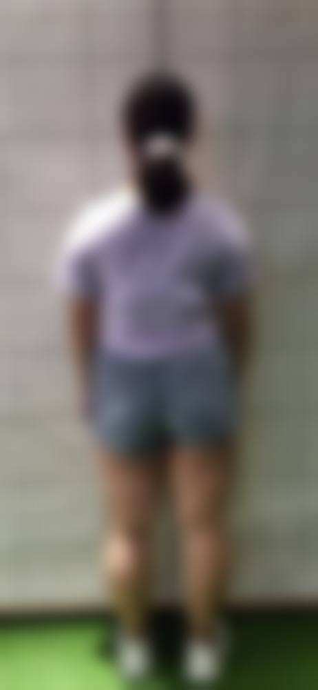 四、武汉甄美医疗美容整形医院特色项目