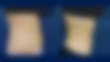 八、韩国皮克瑟整容外科怎么预约？