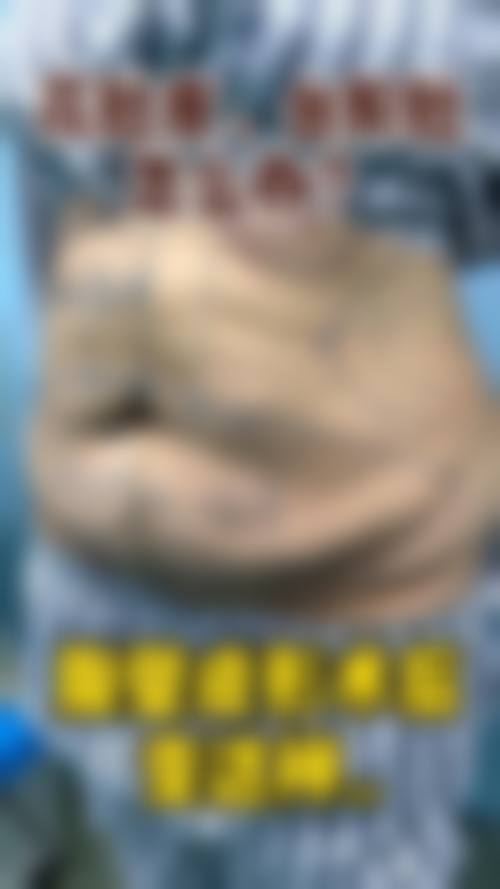 五、韩国皮克瑟整容外科收费价格表