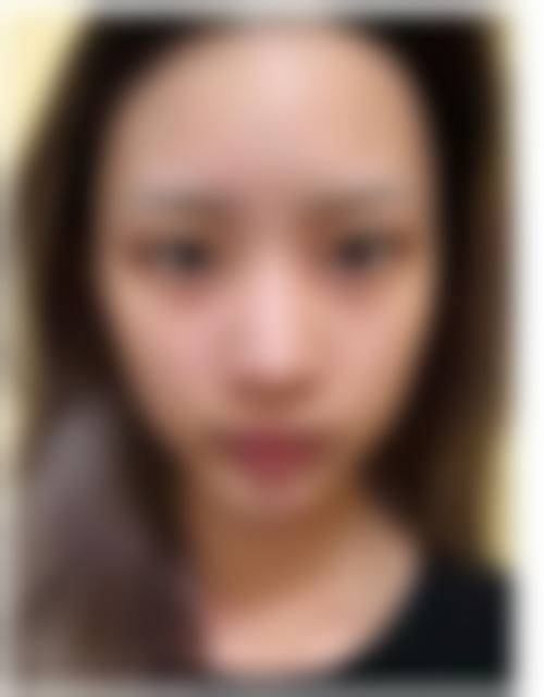 六、长沙禾丽医疗美容门诊部口碑如何？