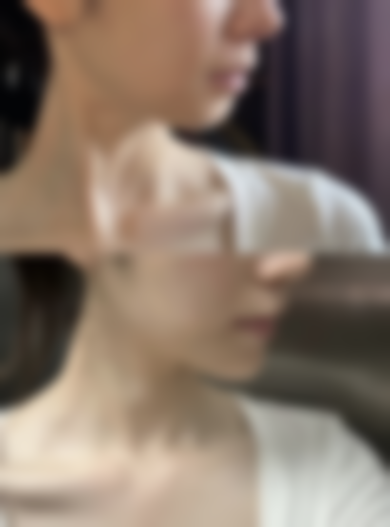 手术疤痕怎么才能淡化掉？多种方法可选，如药物、物理、激光治疗及手术，日常护理也关键！ 