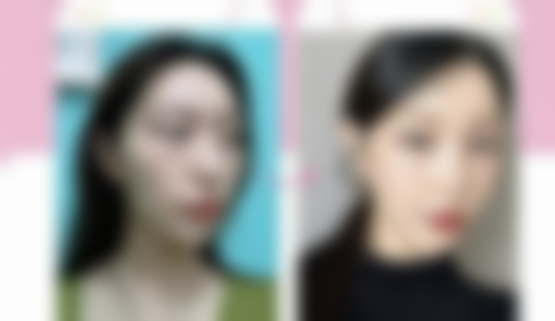 六、 韩国Stanley医院口碑如何？