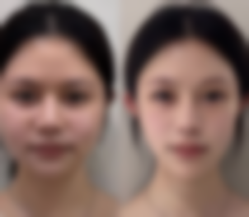 使用护肤品，为眼部肌肤补充营养