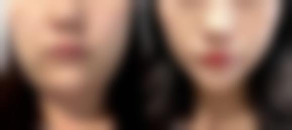 四、周口刘金刚医疗美容刘金刚医生坐诊医院