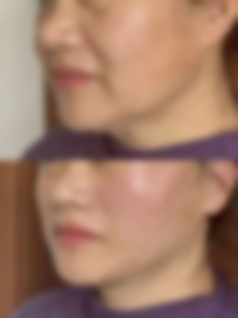 七、诸暨欧莱美整形彭思进医生怎么预约？