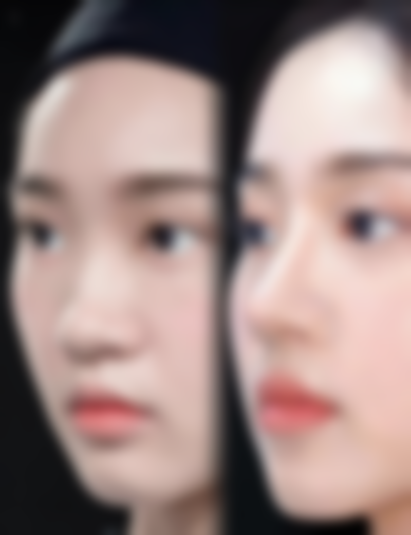 打瘦脸针中毒的症状及实例