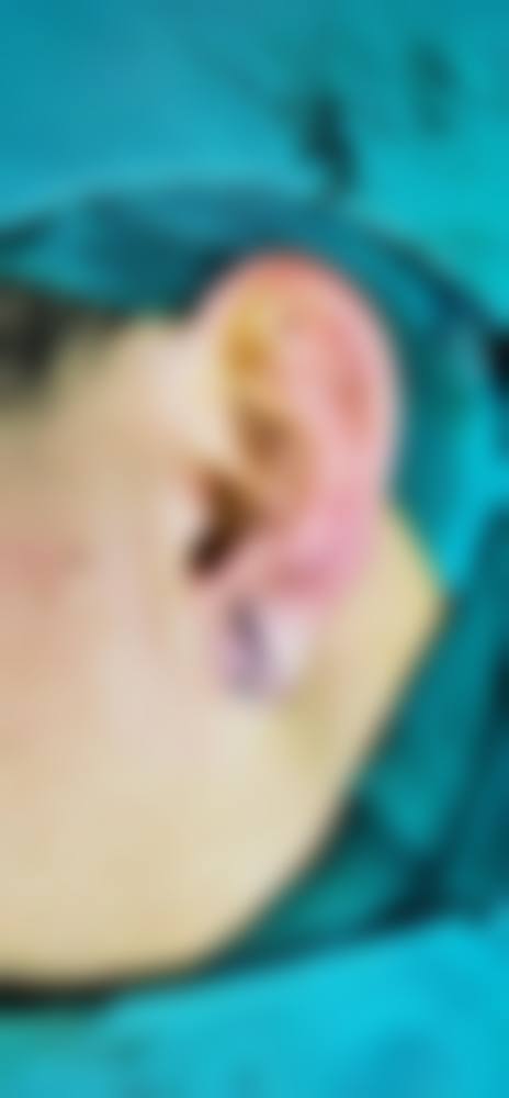 四、佛山德玛肤整形医院特色项目