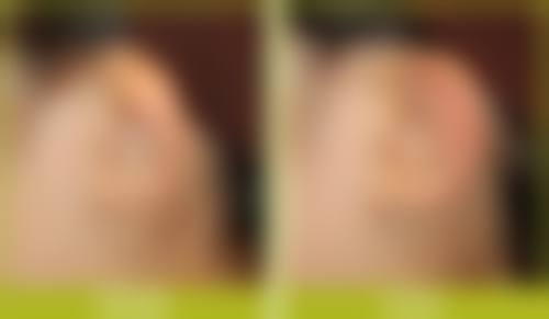 五、佛山德玛肤整形医院收费价格表