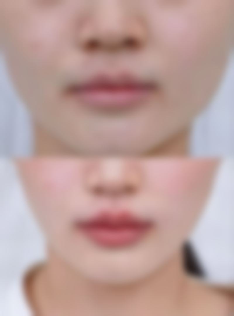 四、贵阳好好整形医院特色项目