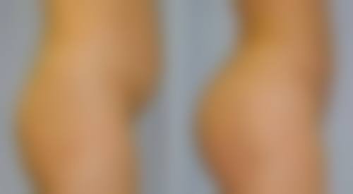 四、维多利亚医疗美容门诊部特色项目