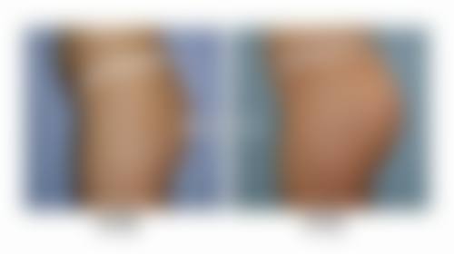 六、维多利亚医疗美容门诊部口碑如何？