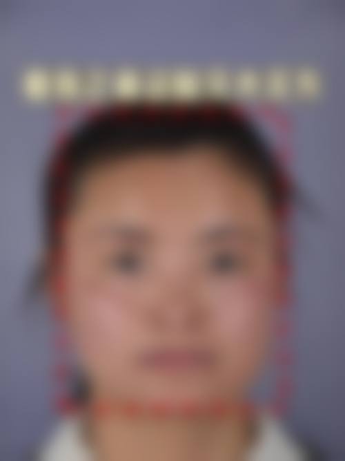 五、上海美道医疗美容收费价格表