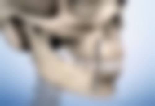 手术治疗疤痕疙瘩