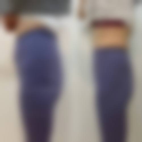 八、西安悦华医疗美容门诊部怎么预约?