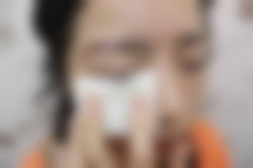 五、武汉大麦微针植发收费价格表