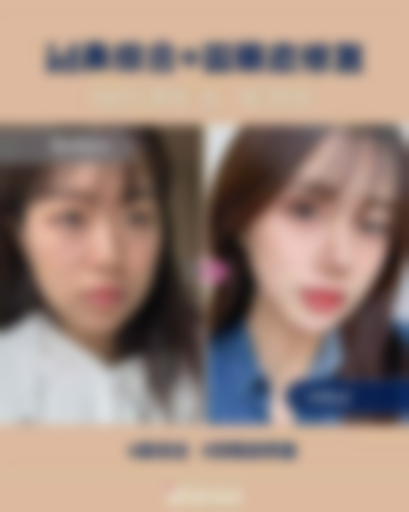 睡眠问题引发4岁孩子眼袋重