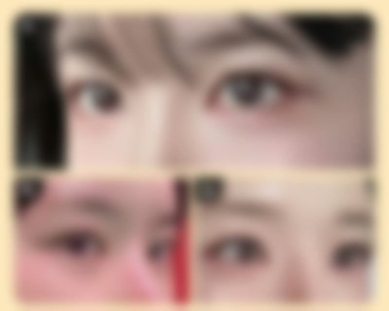 五、延吉赵美花保健整形李龙益医生技术怎么样?