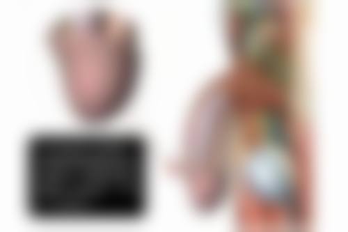 怎么样才能有效的去除眼袋？可从基础护理、药物、物理微创、手术等多方面着手，术后也要注意维持！ 