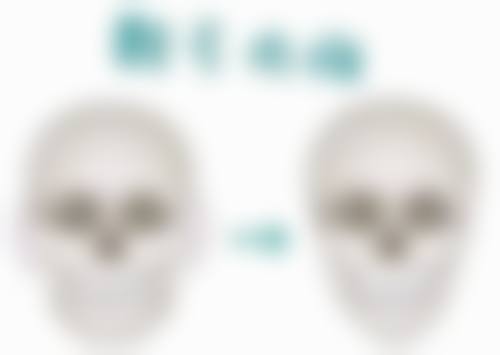 其他去眼袋的方法