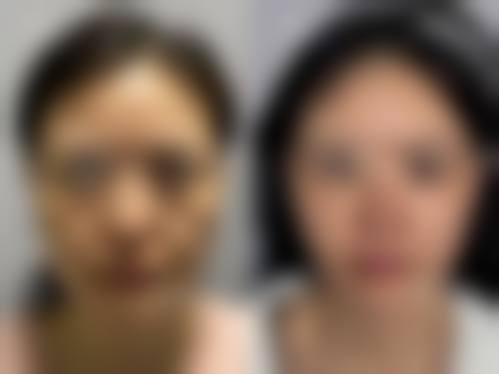 四、淄博友谊医院美容整形科特色项目