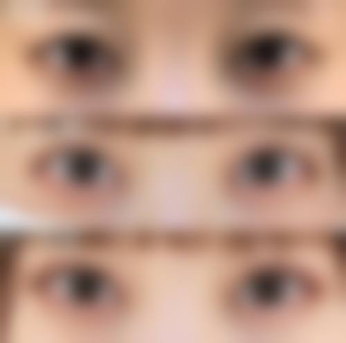 六、合肥淑美医疗美容诊所口碑如何?