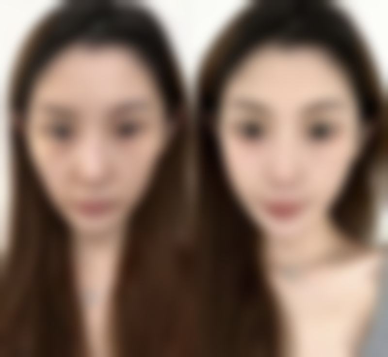 六、淄博友谊医院美容整形科口碑如何？