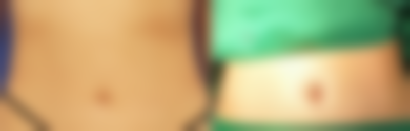 二、南阳丽妃医疗美容刘汉池医生擅长项目