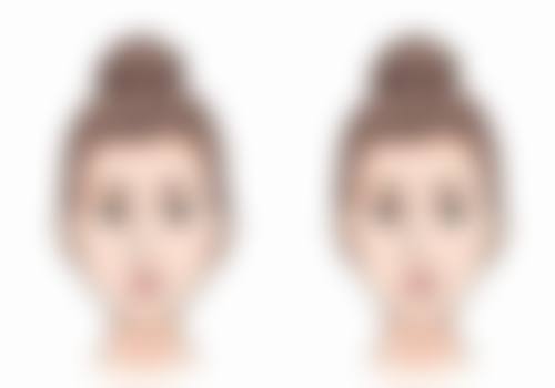 重度情况需手术修复