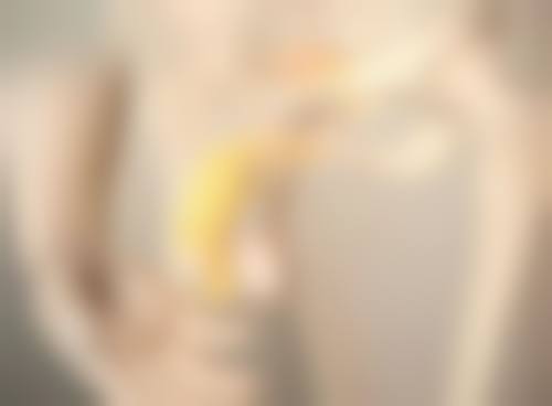 六、成都锦江科瓦齿科徐瑛医生口碑评价及真人实例反馈