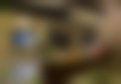 六、厦门思明薇格整形外科张羽医生口碑评价及真人实例反馈