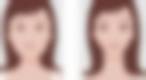 七、成都锦江科瓦齿科徐瑛医生怎么预约?