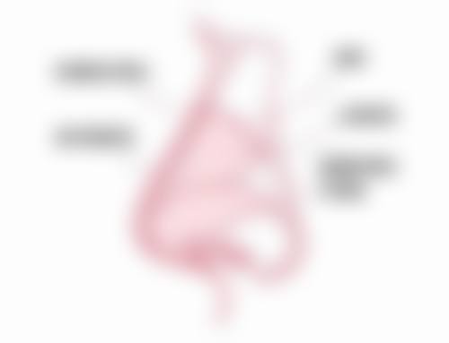 手术治疗：重度疤痕的解决方案