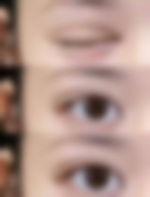 四、盐城市第一人民医院烧伤整形科特色项目