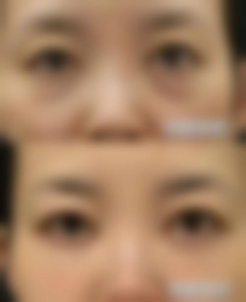 八、盐城市第一人民医院烧伤整形科怎么预约？