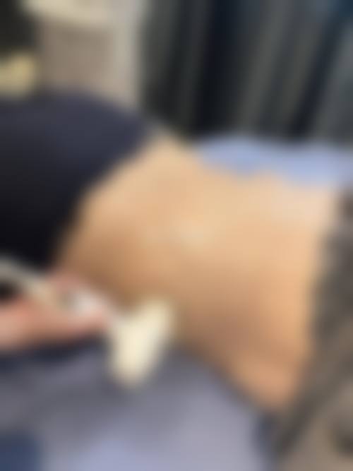 六、阜南汇伊美医疗美容门诊部口碑如何?