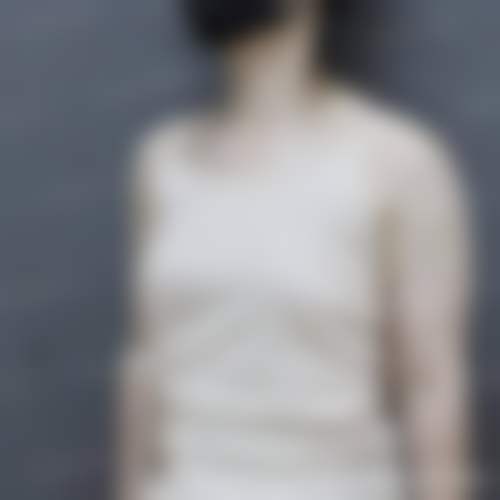 六、北京西美斯Dr.Akila医生口碑评价及真人实例反馈