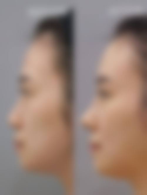 四、武汉洪山爱美汇整形美容门诊部特色项目