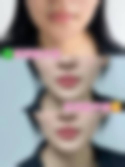 四、宁波极致医疗美容诊所特色项目