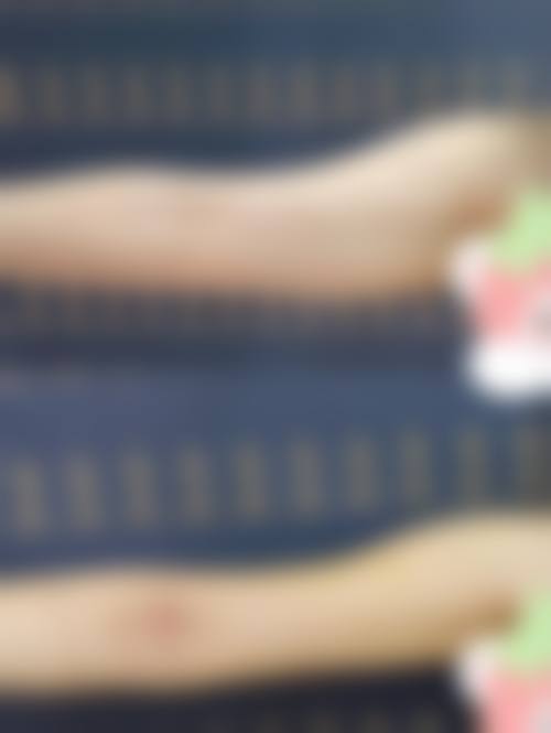 六、宁波极致医疗美容诊所口碑如何?