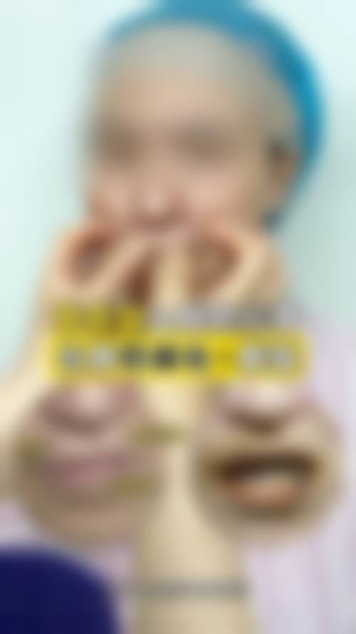 五、成都成华科美之光整形收费价格表