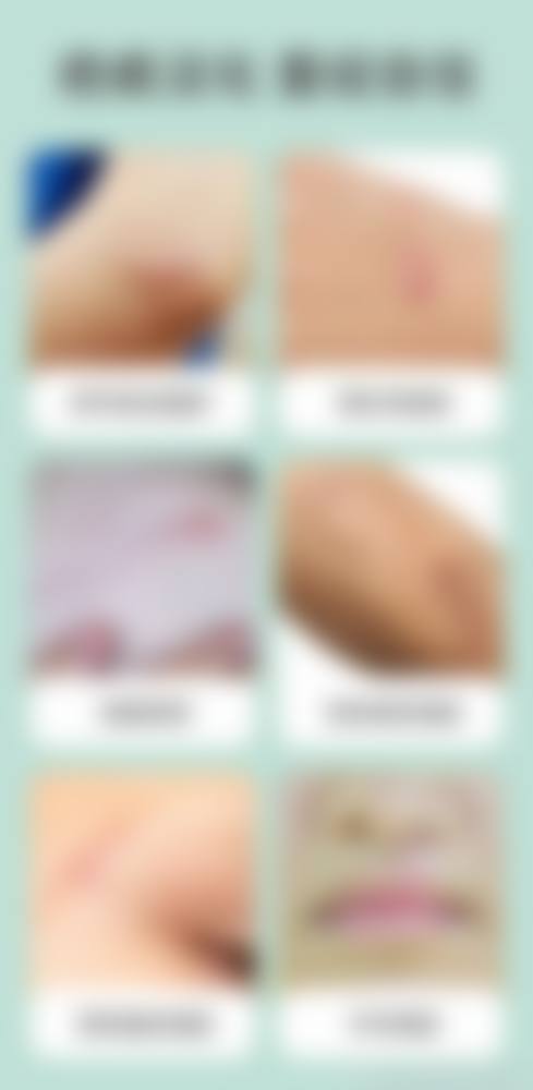 八、成都美呀皮肤医学整形美容怎么预约?