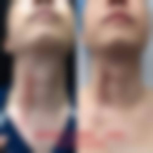 四、成都美呀皮肤医学整形美容特色项目