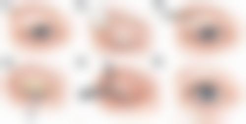 四、韩国可丽妮皮肤科整形外科特色项目