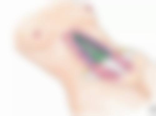 疤痕的暗红怎么去除？可采用药物、物理激光或手术治疗，日常护理也很重要！ 