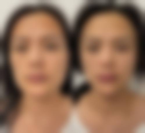 六、天津南开晗熙医疗美容诊所口碑如何？